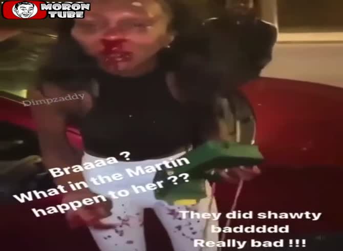 Video :Instagram model unrecognizable after violent assault